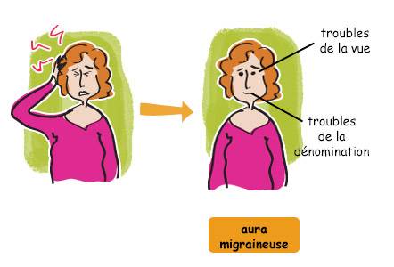 Combien de temps dure une migraine 