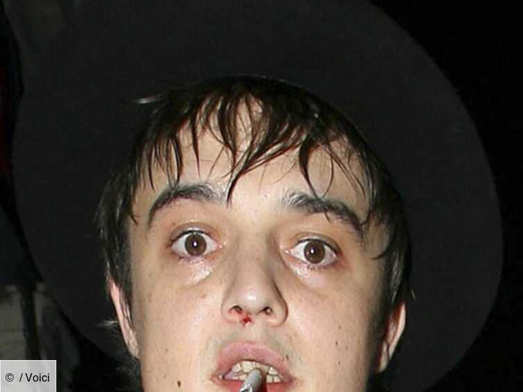 Pete doherty drogue 