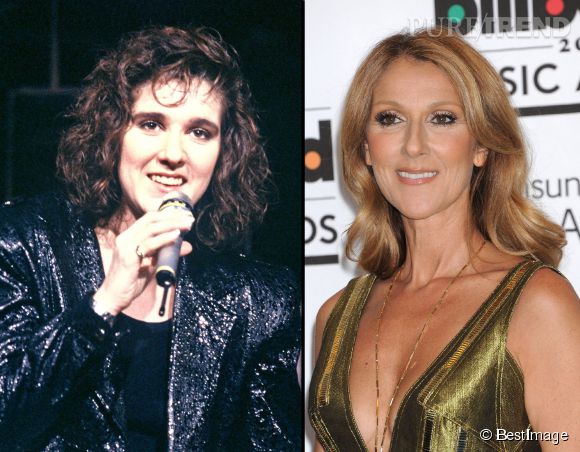 Celine Dion Avant Chirurgie 