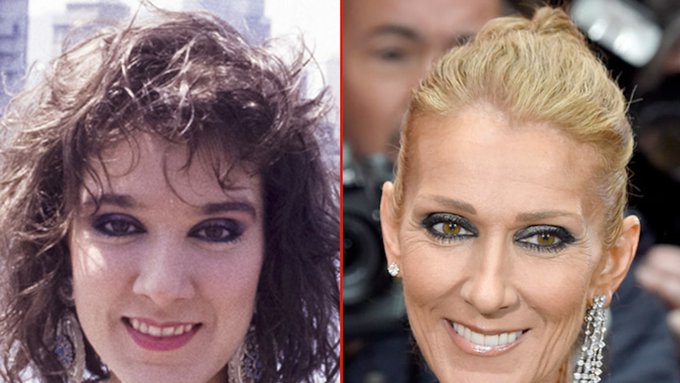 Celine Dion Avant Chirurgie 