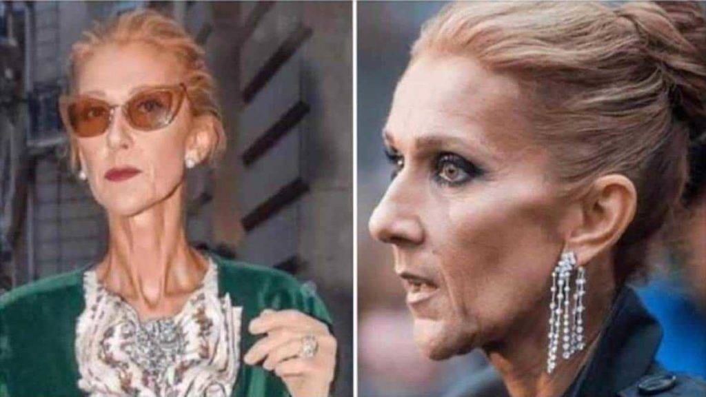 Quelle maladie a celine dion 