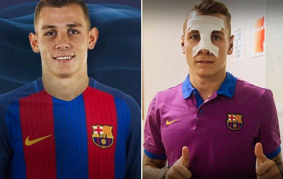 Lucas digne avant chirurgie