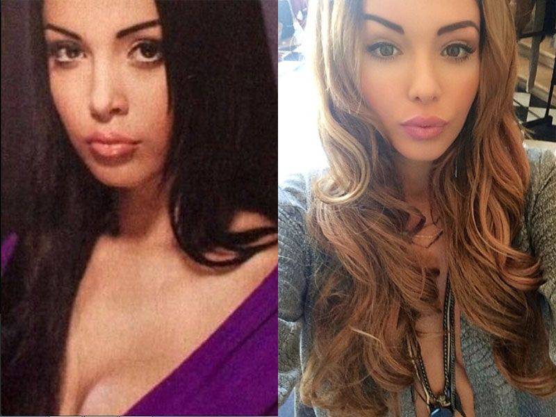 Nabilla avant chirurgie esthétique