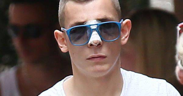 Lucas digne avant chirurgie