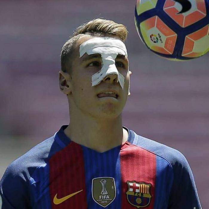 Lucas digne avant chirurgie