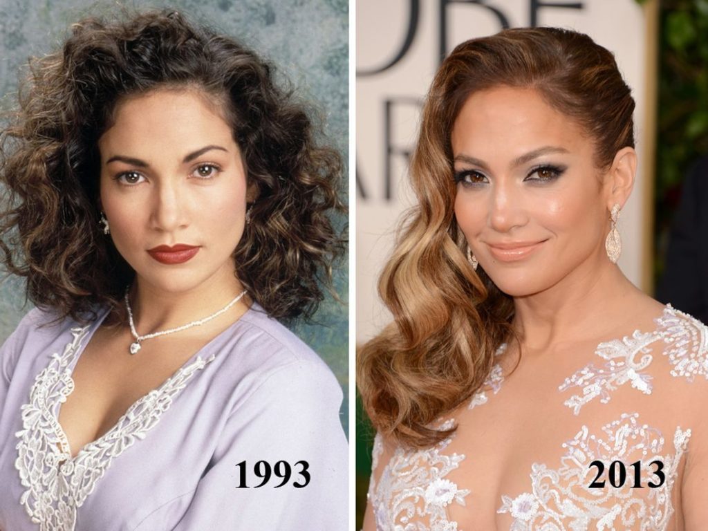 Jennifer lopez chirurgie