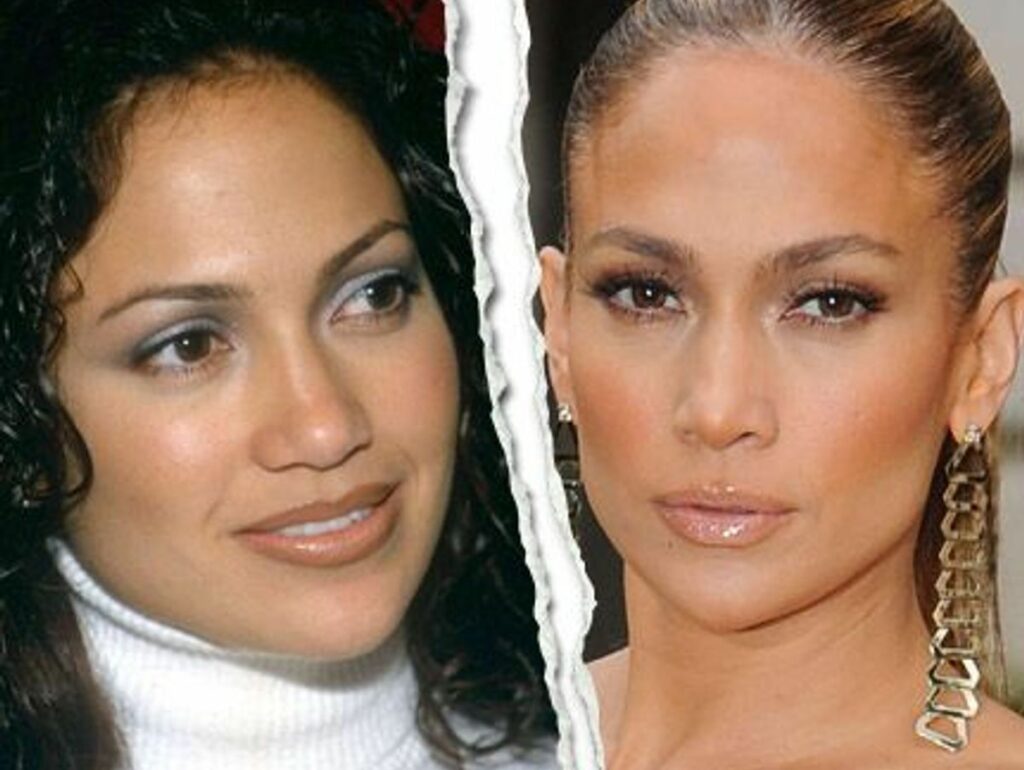 Jennifer lopez chirurgie