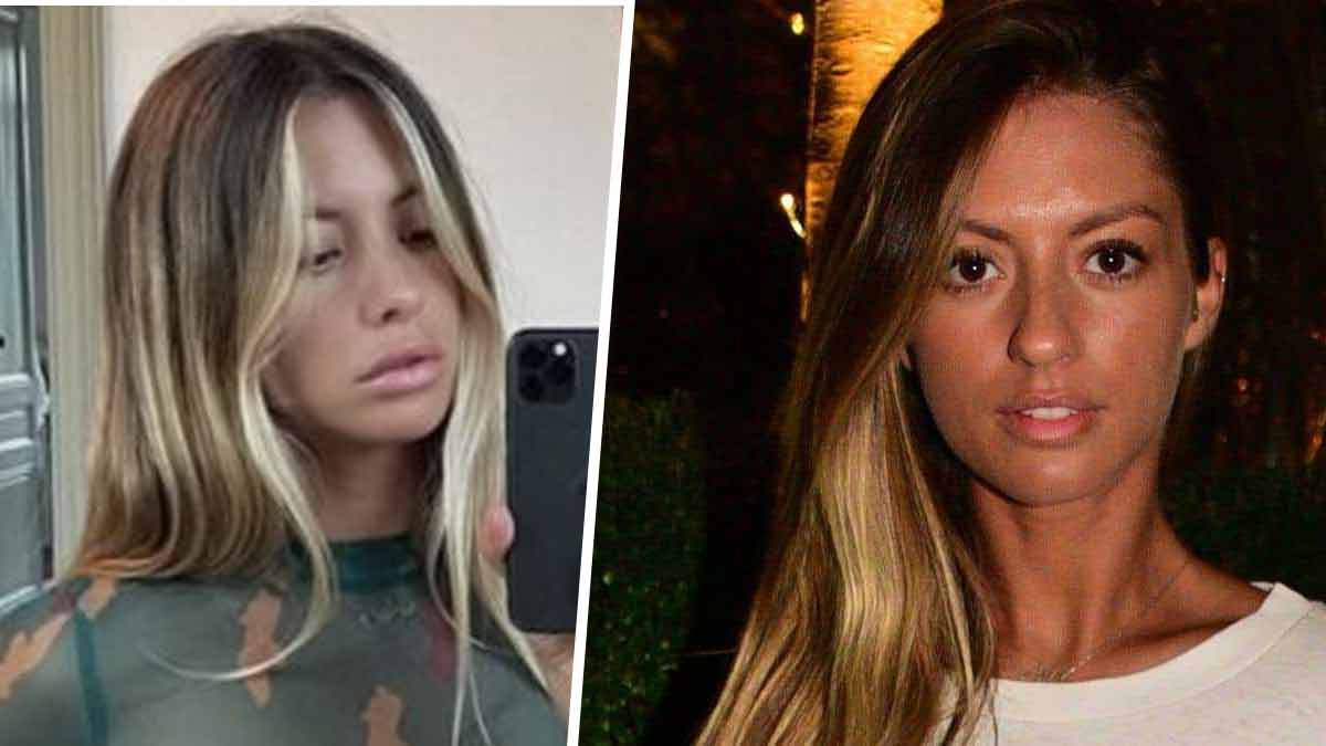 Pauline Tantot Avant Chirurgie - Blaujournal