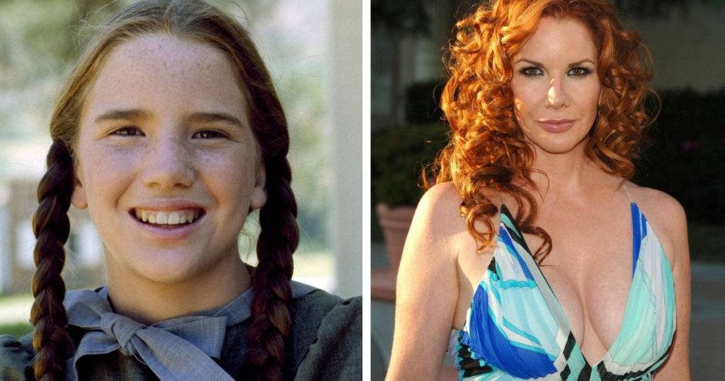 Melissa gilbert chirurgie