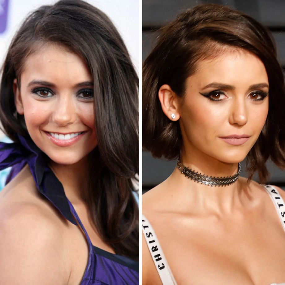 Nina dobrev chirurgie