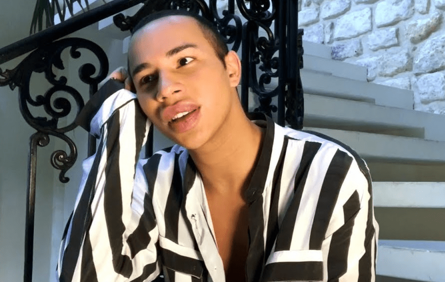 Olivier Rousteing Avant Chirurgie