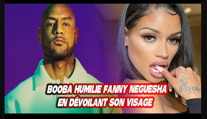 Fanny Neguesha Avant Chirurgie