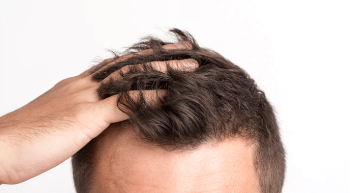 Comment Désépaissir Les Cheveux